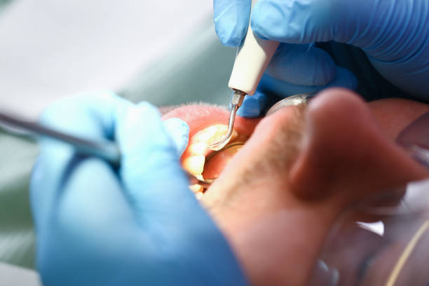 Best Emergency Treatment for Dental Infections or Abscesses in Newbern, TN