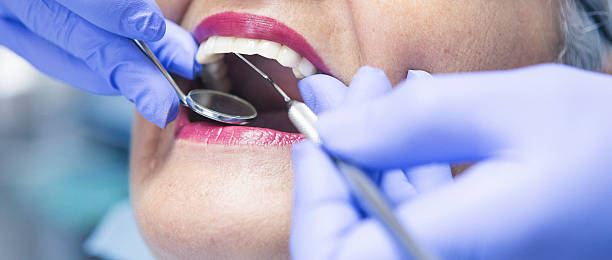 Best Urgent Care for Lost Fillings or Crowns in Newbern, TN